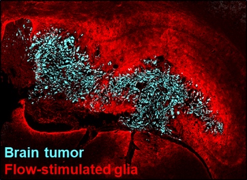 Image showing a brain tumor and adjacent flow-stimulated neural cells